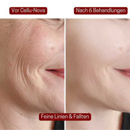 CelluNova™ Micro Infusion System